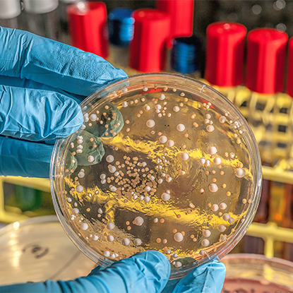 Zdravie a kontrola chorôb